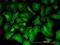 Protein Tyrosine Kinase 7 (Inactive) antibody, H00005754-M06, Novus Biologicals, Immunocytochemistry image 