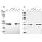 NAD(P)HX Epimerase antibody, PA5-61673, Invitrogen Antibodies, Western Blot image 