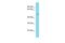 Chromosome 8 Open Reading Frame 76 antibody, PA5-70955, Invitrogen Antibodies, Western Blot image 