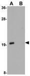 Anaphase Promoting Complex Subunit 13 antibody, GTX85186, GeneTex, Western Blot image 