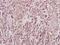 Zinc Finger RANBP2-Type Containing 2 antibody, A07103-2, Boster Biological Technology, Immunohistochemistry frozen image 