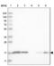 Ciliary Neurotrophic Factor antibody, NBP1-83277, Novus Biologicals, Western Blot image 