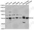 Hexosaminidase Subunit Alpha antibody, A5646, ABclonal Technology, Western Blot image 