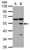 Secernin 1 antibody, PA5-32085, Invitrogen Antibodies, Western Blot image 