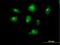 Centromere Protein I antibody, H00002491-B01P, Novus Biologicals, Immunocytochemistry image 