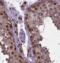 FA Complementation Group D2 antibody, FNab03007, FineTest, Immunohistochemistry paraffin image 