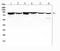 RDX antibody, A01926-1, Boster Biological Technology, Western Blot image 