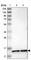 Cysteine Rich DPF Motif Domain Containing 1 antibody, HPA018823, Atlas Antibodies, Western Blot image 