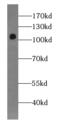 MIS18 Kinetochore Protein A antibody, FNab01089, FineTest, Western Blot image 