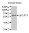 Lysophosphatidylcholine Acyltransferase 1 antibody, PA5-76180, Invitrogen Antibodies, Western Blot image 