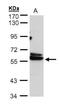 Chaperonin Containing TCP1 Subunit 4 antibody, NBP1-32385, Novus Biologicals, Western Blot image 