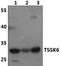 Testis Specific Serine Kinase 6 antibody, PA5-75952, Invitrogen Antibodies, Western Blot image 