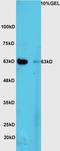 Zinc Finger E-Box Binding Homeobox 1 antibody, orb6954, Biorbyt, Western Blot image 