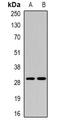 Carcinoembryonic Antigen Related Cell Adhesion Molecule 7 antibody, orb377990, Biorbyt, Western Blot image 