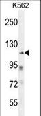 Zinc Finger Protein 99 antibody, LS-C160965, Lifespan Biosciences, Western Blot image 