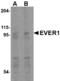 Transmembrane Channel Like 6 antibody, LS-C53286, Lifespan Biosciences, Western Blot image 