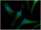 Cytosolic acyl coenzyme A thioester hydrolase antibody, NBP2-22569, Novus Biologicals, Immunocytochemistry image 