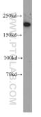 Myosin Heavy Chain 11 antibody, 60222-1-Ig, Proteintech Group, Western Blot image 