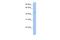 Transmembrane And Tetratricopeptide Repeat Containing 2 antibody, A13836, Boster Biological Technology, Western Blot image 