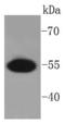 Pre-MRNA Processing Factor 19 antibody, A02434-2, Boster Biological Technology, Western Blot image 