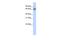 Poly(A) Polymerase Gamma antibody, PA5-41901, Invitrogen Antibodies, Western Blot image 