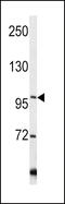 Collagen Type VI Alpha 1 Chain antibody, 62-346, ProSci, Western Blot image 