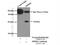 Dehydrogenase/Reductase 2 antibody, 15735-1-AP, Proteintech Group, Immunoprecipitation image 