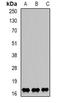 Lipopolysaccharide Induced TNF Factor antibody, orb378156, Biorbyt, Western Blot image 