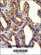Tumor Associated Calcium Signal Transducer 2 antibody, 62-399, ProSci, Immunohistochemistry paraffin image 