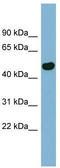 Calcium Release Activated Channel Regulator 2A antibody, TA346646, Origene, Western Blot image 