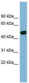 EF-hand calcium-binding domain-containing protein 4B antibody, TA346646, Origene, Western Blot image 