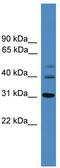 Tribbles Pseudokinase 1 antibody, TA340201, Origene, Western Blot image 