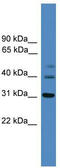 Tribbles Pseudokinase 1 antibody, TA340201, Origene, Western Blot image 