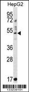 E3 ubiquitin-protein ligase TRIM11 antibody, MBS9206358, MyBioSource, Western Blot image 