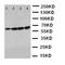 Interleukin 1 Receptor Associated Kinase 1 antibody, orb75887, Biorbyt, Western Blot image 