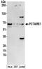 Cyclin Dependent Kinase 16 antibody, NBP2-32254, Novus Biologicals, Western Blot image 
