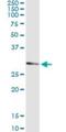 Uridine-cytidine kinase 2 antibody, H00007371-M03, Novus Biologicals, Western Blot image 