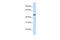 Glycosyltransferase 8 Domain Containing 1 antibody, 25-985, ProSci, Western Blot image 