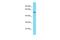 Leukotriene-B4 omega-hydroxylase 3 antibody, A30073, Boster Biological Technology, Western Blot image 
