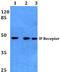 Prostaglandin I2 Receptor antibody, A04378, Boster Biological Technology, Western Blot image 