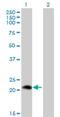 Phospholipase A2 Group XIIA antibody, H00081579-M01, Novus Biologicals, Western Blot image 