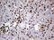 SSU72 Homolog, RNA Polymerase II CTD Phosphatase antibody, LS-C791947, Lifespan Biosciences, Immunohistochemistry paraffin image 