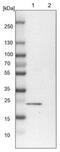 TBC1 Domain Family Member 7 antibody, NBP1-84231, Novus Biologicals, Western Blot image 