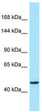 Acyl-CoA Dehydrogenase Family Member 10 antibody, TA343057, Origene, Western Blot image 