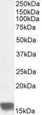 Ubiquitin Conjugating Enzyme E2 I antibody, PA1-9111, Invitrogen Antibodies, Western Blot image 