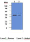 Caspase 2 antibody, LS-C93694, Lifespan Biosciences, Western Blot image 