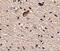 Sprouty Related EVH1 Domain Containing 1 antibody, NBP2-81927, Novus Biologicals, Immunohistochemistry frozen image 