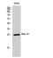 RAB2A, Member RAS Oncogene Family antibody, A06007-1, Boster Biological Technology, Western Blot image 