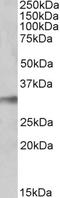 NIMA Related Kinase 7 antibody, EB10520, Everest Biotech, Western Blot image 