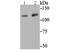 Bifunctional protein NCOAT antibody, NBP2-76848, Novus Biologicals, Western Blot image 